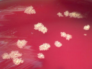 Colonias de Gordonia araii, de color gris claro, de aspecto seco, superficie rugosa y bordes irregulares, después de 5 días de incubación en agar sangre. La muestra cultivada procede de biopsia de tumoración nodular cutánea.