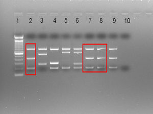 Multiplex PCR (Suis-ladder11) differentiating B. suis biovars. Lane1: ladder (100base pairs). Lanes 2–6: B. suis reference (control) strains: B. suis biovar 1 – 1330 – (2), B. suis biovar 2-Thomsem – (3), B. suis biovar 3 – 686 – (4), B. suis biovar 4 – 40 – (5), B. suis biovar 5 – 513 – (6). Lanes 7–8: case strain. Lane 9: B. suis biovar 1 reference 1330 control strain (repeated to facilitate comparisons). Lane 10: negative control.