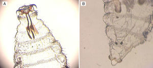 Detalle de larva de Oestrus ovis de primer estadio. A) Se observa un polo superior con ganchos bucales bien desarrollados con forma de cuerno, unidos a un esqueleto cefalofaríngeo prominente. B) Se observa el extremo caudal con presencia de 2 abultamientos terminales con numerosas espinas.