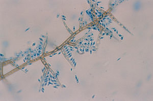 Examen microscópico con azul de lactofenol (×400). Células conidiógenas con collaretes en forma de embudo y conidias cilíndricas.