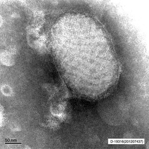 Otra visualización del Pseudocowpox, visto por microscopia electrónica en la muestra remitida al Centro Nacional de Microbiología.