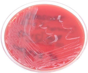 Aislamiento de Corynebacterium pseudotuberculosis en agar sangre.
