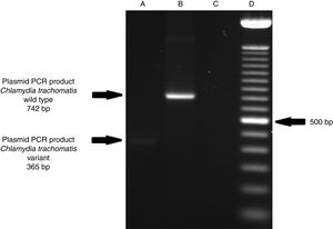 Detection of the Swedish nvCT in clinical samples by PCR. The image shows the PCR results used to determine the presence of 377bp deletions in the C. trachomatis cryptic plasmid. Well (A), indicates the presence of a 365bp product, which is associated with the reported 377bp deletion.2 Well (B), shows the presence of a 742bp product obtained from C. trachomatis with no plasmid deletion (plasmid DNA from C. trachomatis ATCC® VR-902B), Well (C), is the negative control (HeLa cell DNA), and Well (D) a 100bp DNA ladder (Invitrogen, CA, USA).