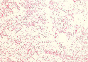 Blood culture gram stain at 1000× magnification.