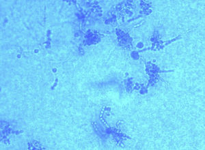 Visión microscópica tras tinción con azul de lactofenol.
