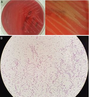A) Cultivo en agar Wilkins-Chalgren. B) Tinción de Gram.