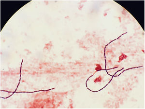 Gram stain of anaerobic blood culture (1000×): Gram positive long and straight-ended bacilli.