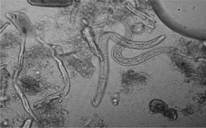 Larva rabdtoide de Strongyloides stercoralis en heces. Examen en fresco. 10x.