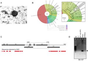 HPV18 DNA in EV derived from HeLa cell line. (A) Electron microscopy of extracellular vesicles from HeLa cells showing the typical morphology. (B) Graphical representation of the unnormalized abundance of VPH in terms of number of reads. (C) Sequences of HPV detected in EV by NGS are indicated in the lower graph. The ORFs are indicated in the whole genome HPV-18 map. The dashed square comprises the region deleted in the inserted genome. (D) Detection of the region E6/E7 of HPV18 in HeLa cells and EV derived from this cell line but not in those derived from HPV-negative cells. M, 100bp DNA ladder.