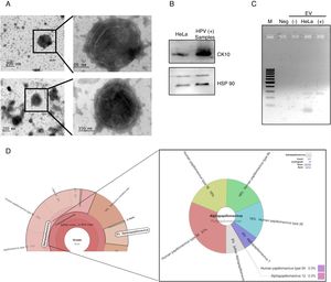 DNA of HPV in EV derived from HPV-positive cervical samples. (A) Electron microscopy of extracellular vesicles from positive (top panel) and negative (lower panel) samples. (B) Detection of CK10 and HSP90 proteins in EV from HPV-positive cervical samples by immunoblot. (C) Detection of the region E6/E7 of HPV18 in EV derived from HPV-positive samples but not in those derived from HPV-negative cells. The EV of HeLa cells was employed as a positive control. Neg, negative control without template. M, 100bp DNA ladder. (D) Graphical representation of the unnormalized abundance of VPH in terms of number of reads and the viral types detected, in EV from a representative sample.
