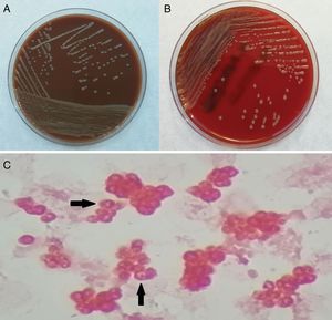 Mucoid colonies of Paracoccus yeei isolated on Chocolate agar (A) and Blood agar (B) after 48h of incubation. Direct Gram stain from the aerobic blood culture bottle revealed Gram negative cocci with characteristic “doughnut-shape” (arrows) (C).