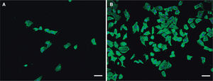 Efecto citopático de una cepa clínica de Hafnia alvei sobre células Vero. Nótese la disrupción de la monocapa de células (A) comparada con un control de células sin infectar (B). El citoesqueleto celular está teñido (verde) con faloidina Atto-488 y los núcleos celulares (azul) con DAPI. Las preparaciones se han fotografiado con un microscopio confocal Nikon A1R y un objetivo 340 Plan-Fluor 1.3 NA. Barras de escala, 50μm.