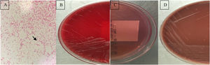 (A) Gram stain of Brucella melitensis; (B) colony morphology of Brucella melitensis on blood agar; (C) absence of growth on MacConkey agar; (D) colony morphology of Brucella melitensis on chocolate agar.