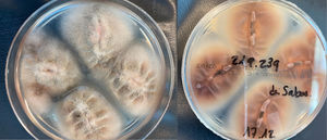 Aspecto macroscópico, anverso (derecha) y reverso (izquierda), de las colonias de Monascus ruber en agar Sabouraud-cloranfenicol.