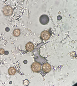 Características microscópicas de Monascus ruber (40x). Se aprecian conidióforos con cadenas de conidias lisas y piriformes de base truncada y presencia de cleistotecios.