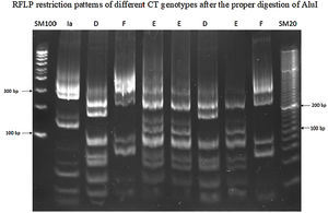 RFLP restriction patterns of different CT genotypes after the proper digestion of AluI.
