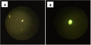 Microscopía óptica. A) Restos de protoescólices. B) Escólex.
