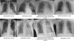 Radiological evolution patients 1 & 2.