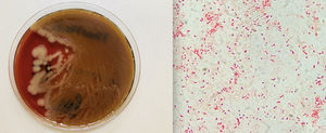 Izquierda: aspecto de las colonias a las 24h de incubación en medio de agar sangre y atmósfera enriquecida en CO2. Derecha: bacilos gramnegativos pleomorfos en la tinción de Gram.