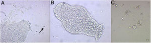 Estudio microscópico del contenido del quiste hidatídico. A) Protoescólice de Echinococcus granulosus (E. granulosus), donde se observan ganchos (señalado con la flecha) (20×) B) Protoescólice evaginado de E. granulosus de 220μm, donde se intuye la corona de ganchos y las ventosas (20×) C) Detalle de los ganchos ampliados (40×).
