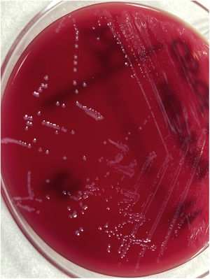 Cultivo puro de Alistipes finegoldii en agar sangre en anaerobiosis. Se observan típicas colonias elevadas, circulares y opacas.