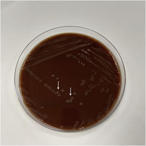 Cultivo de líquido articular en medio de agar chocolate, en el que se observa crecimiento de colonias traslúcidas/grises indicativas de Nesseriagonorrhoae (flechas blancas).