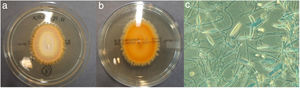 a) Anverso colonia N. praecox. b) Reverso colonia N. praecox. c) Observación bajo microscopia de contraste de hifas y macroconidias septadas de N. praecox. Tinción azul de lactofenol ×400.