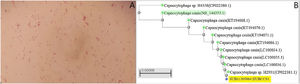 A) Se observan bacterias gramnegativas con forma de bastón después de 3 días de incubación crecidas en los dos frascos anaeróbicos del hemocultivo. B) Árbol filogenético obtenido tras comparar las secuencias de varias cepas de C. canis con la secuencia de la cepa del presente caso (número de acceso: SUB11305064 HUBCCS1) mediante el método de neighbor joining. Nuestra cepa tenía un 99,57% de coincidencia de identificación con las cepas cercanas (CP022381.1, LC100034.1, LC100035.1 o LC100036.1, pertenecientes a los artículos de Oldham y Duncan1 y Suzuki et al.2) y un 99% con la cepa de referencia (C. canis type strain LMG29146, resaltada en verde en la figura 1B) demostrándose la similitud entre ellas.