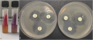 Identificación de Shigella spp. y detección de la presencia de una betalactamasa de espectro extendido (BLEE). A) Izquierda: medio TSI (triple azúcar-hierro), se observa fermentación de glucosa sin producir gas; derecha: medio LIA (lisina-hierro), se observa que no descarboxila ni desamina la lisina. B) Técnica de disco-difusión con los kits de confirmación «Total ESBL, AmpC and ESBL+AmpC Confirm kit» (ROSCO Diagnostica A/S, Taastrup, Dinamarca). Se observa el aumento del halo (> 5mm) de cefotaxima y ceftazidima en presencia del ácido clavulánico pero no en presencia de cloxacilina, confirmándose la presencia de una BLEE.