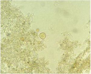 Cyst of Entamoeba histolytica.