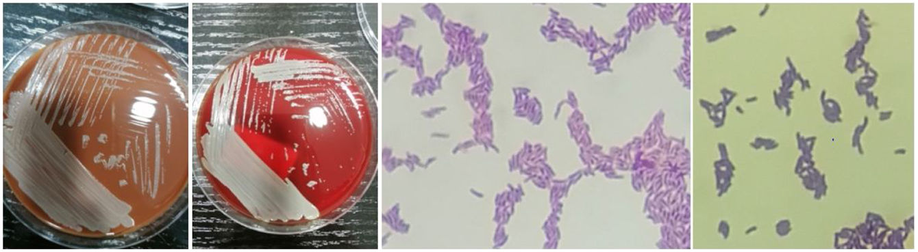Auritidibacter ignavus en muestras óticas de pacientes pediátricos ...
