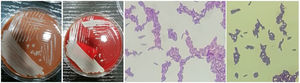 Izquierda: aspecto de las colonias a las 48 h de incubación en agar chocolate y en agar sangre. Derecha: bacilos grampositivos en la tinción de Gram.
