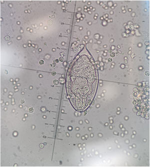 Huevo largo y ovalado (110-170μm largo por 40-70μm ancho) con un espolón terminal. Diagnóstico de infección por Schistosoma haematobium.