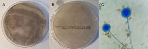 A y B) Anverso y reverso de colonias tras 48 h de incubación en agar Sabouraud. C) Syncephalastrum spp. teñido con azul de lactofenol.