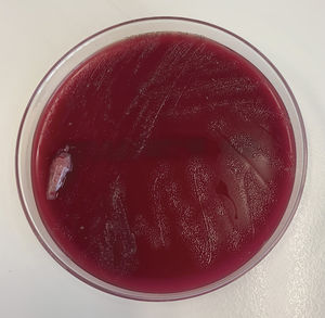 Cultivo de la placenta en agar sangre. Se observa el aspecto de las colonias tras 48h de incubación a 35°C con 5% de CO2.