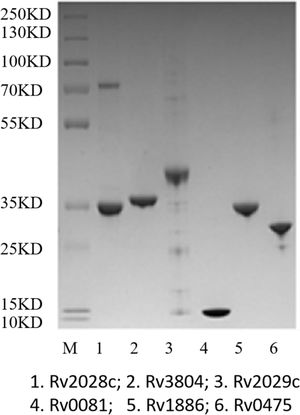 SDS-PAGE results of the purified LTBI and ATB antigens. 1, 3, 4, 6 were LTBI-antigens Rv2028c, Rv2029c, Rv0081, and Rv0475; 2 and 5 were ATB antigens Rv3804 and Rv1886.