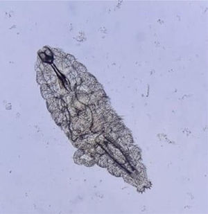 Larva de primer estadio de Oestrus ovis mediante examen con microscopio óptico (10×)1.