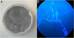 A) Cultivo del hongo en medio Sabouraud con patrón de crecimiento agresivo que alcanza la tapa de la placa Petri, y B) tinción de blanco de calcoflúor sobre muestra quirúrgica de tejido profundo, con visualización de hijas sin septos y ramificaciones en ángulo recto.