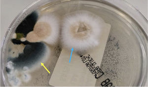 Crecimiento en placa de cultivo de agar Sabouraud de colonias sugestivas de Aspergillus fumigatus (flecha amarilla) y Aspergillus terreus (flecha azul).