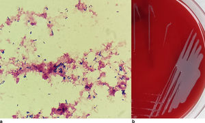 Aspecto macroscópico y microscópico de Brevibacterium casei. (a) Tinción de Gram de muestra directa de hemocultivo. (b) Aspecto macroscópico de las colonias de B. casei en agar sangre incubado a 37°C en atmósfera CO2.