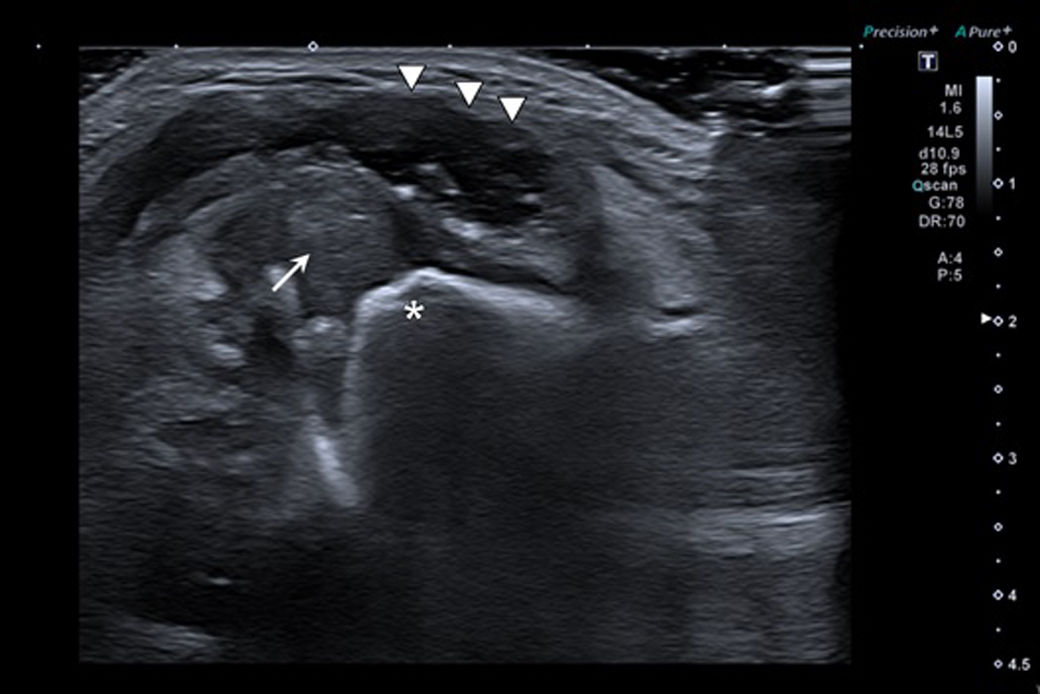 fig0005
