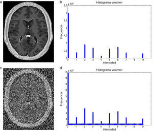 Adición de ruido multiplicativo a imágen de phantom de IRM del cerebro. (a) Corte axial 98 de phantom original. (b) Histograma de (a). (c) Imagen original (a) con ruido multiplicativo. (d) Histograma de (c).
