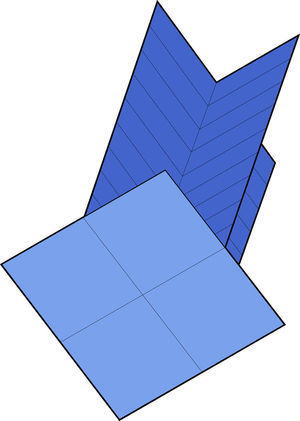 Esquema de rigidización de apoyo utilizado.