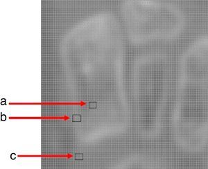 Imagen ampliada de TC del pie. a) Región de píxeles que representan el tejido óseo cortical; b) región de píxeles que representan el tejido óseo trabecular; c) región de píxeles que representan el tejido blando.