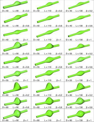 Representación esquemática de todos los modelos de AAA analizados. Diámetro máximo del aneurisma (D), longitud del aneurisma (L) y asimetría (β).