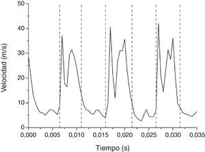 Valores de la componente u de la velocidad en el eje del inyector en el punto de medición (20,0,0) (fig. 1) para una frecuencia de pulsación de 100Hz y puntos de cambio encontrados (rectas a trazos) mediante el estimador CPM-CvM.