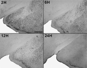 Fotografías de secciones de cerebros (×2,5) que muestran la activación en el núcleo amigdalino medial posterodorsal y el posteroventral a distintas sobrevidas luego de la inyección de pentilentetrazol. Escala barra: 500μm.