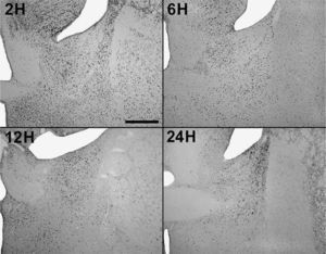 Fotografías de secciones de cerebros (×2,5) que muestran la activación en el núcleo intersticial de la estría terminal anterior y ventral a distintas sobrevidas luego de la inyección de pentilentetrazol. Escala barra: 500μm.