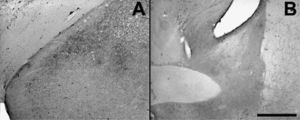 Fotografías de secciones de cerebros (×2,5) que muestran en A el núcleo amigdalino medial posterodorsal y el posteroventral, en B el núcleo intersticial de la estría terminal anterior y ventral de animales con sobrevida de 24h luego del estado epiléptico y que se procesó con la técnica A-Cu-Ag.