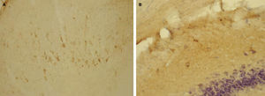 PrPc en la corteza frontal (A) y en el hipocampo (B) de rata. Se ha realizado un contraste con hematoxilina-eosina para el hipocampo.